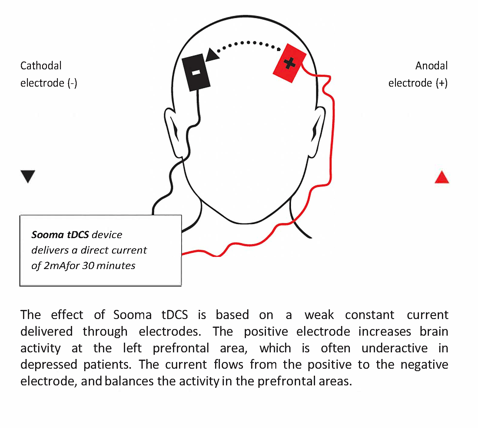 How Sooma tDCS works in the brain